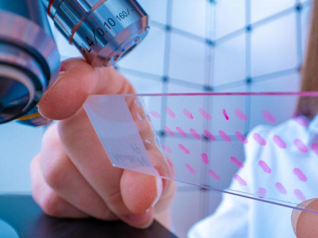 Female lab tech looking at plate under microscope